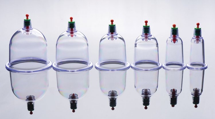 MASTER SERIES SUKSHEN 6 PC CUPPING SET